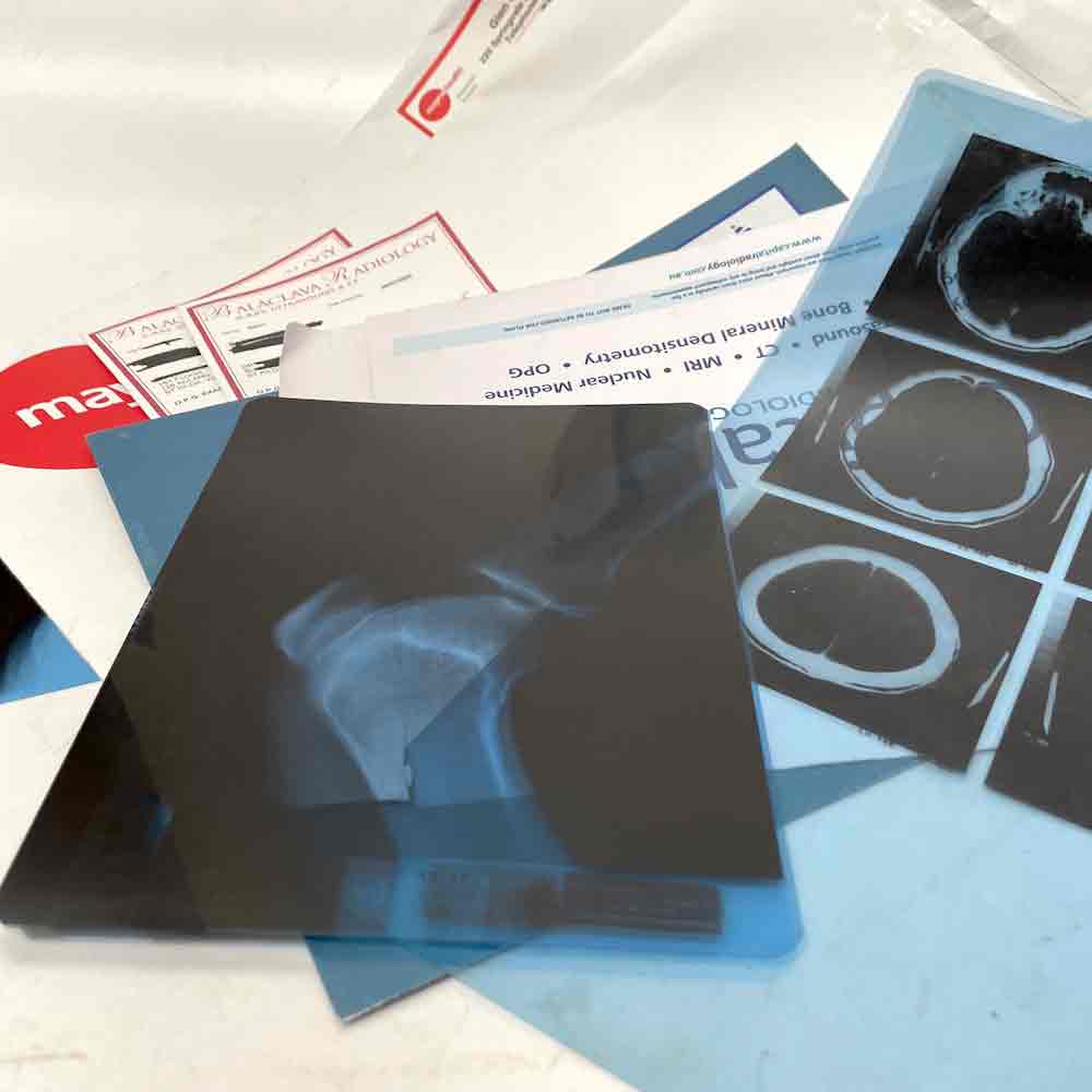 XRAY, Set of in Envelope or XRA0002 - XRAY, Single Image